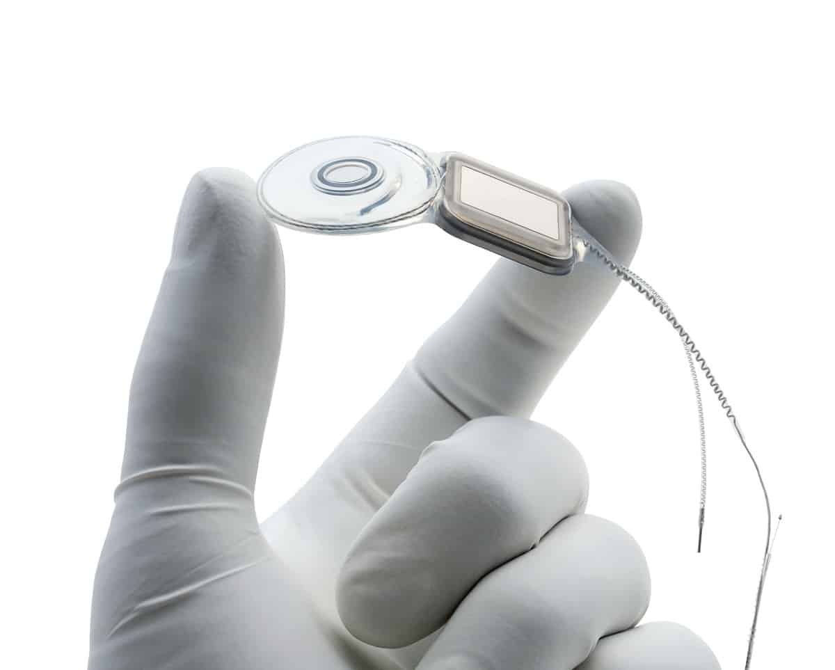Implante coclear Nucleus con procesador de sonido